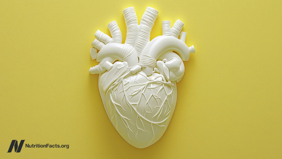 The Risks vs. Benefits of Angioplasty and Heart Stents 