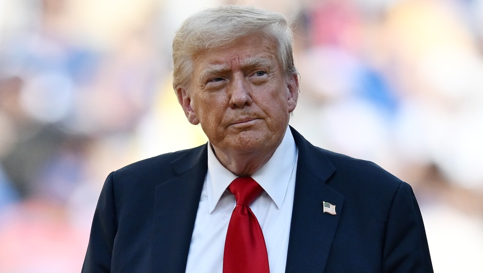 Donald Trump Diagnosed With 'Common' Vein Condition After Leg Swelling